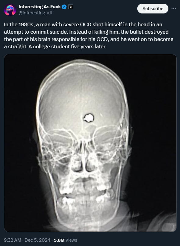 From OCD to PHD