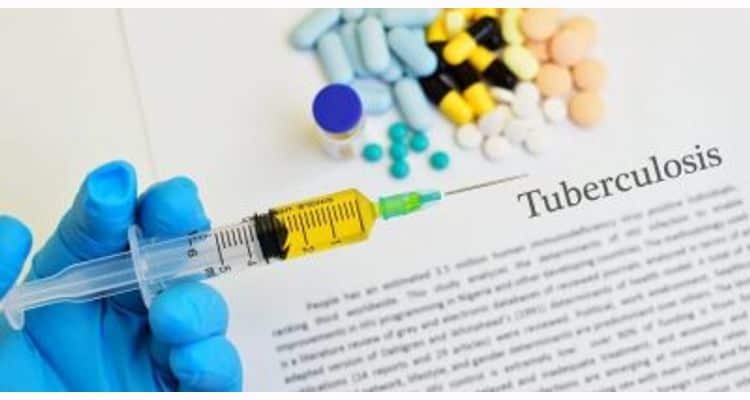 SATB launches framework addressing TB and mental health intersection