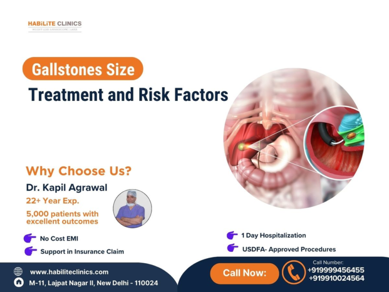 Gallstones Size : Understanding Treatment and Risk Factors
