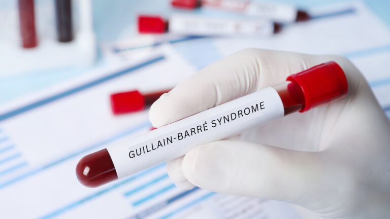 GBS: When Your Immune System Becomes Your Worst Enemy