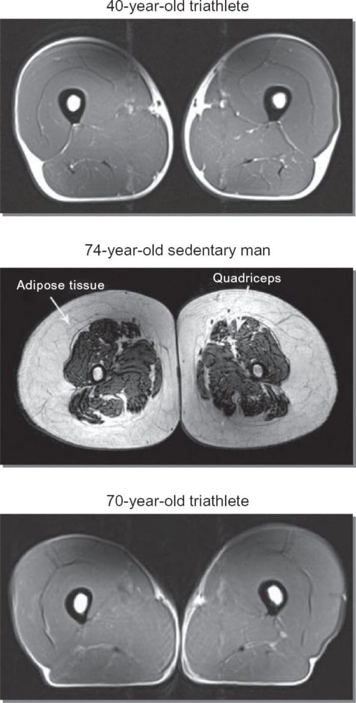 X-ray scans showing cross sections of leg tissue between a triathlete and a sedentary man
