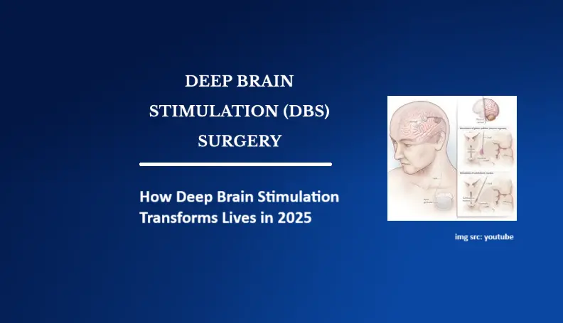 Rewiring Hope: How Deep Brain Stimulation Transforms Lives in 2025