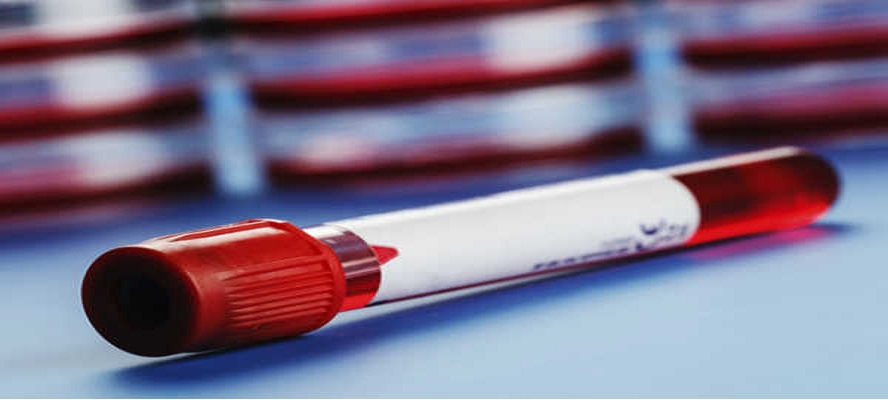 New blood test can detect cancer with 98 per cent accuracy