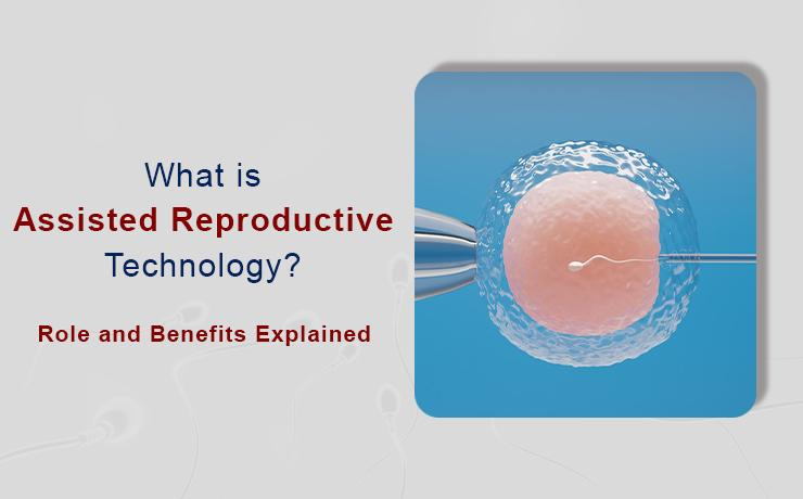 What Is Assisted Reproductive Technology? Role and Benefits Explained