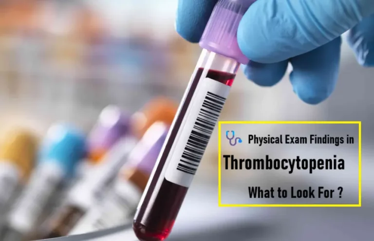 5 Physical Exam Findings in Thrombocytopenia: What to Look For